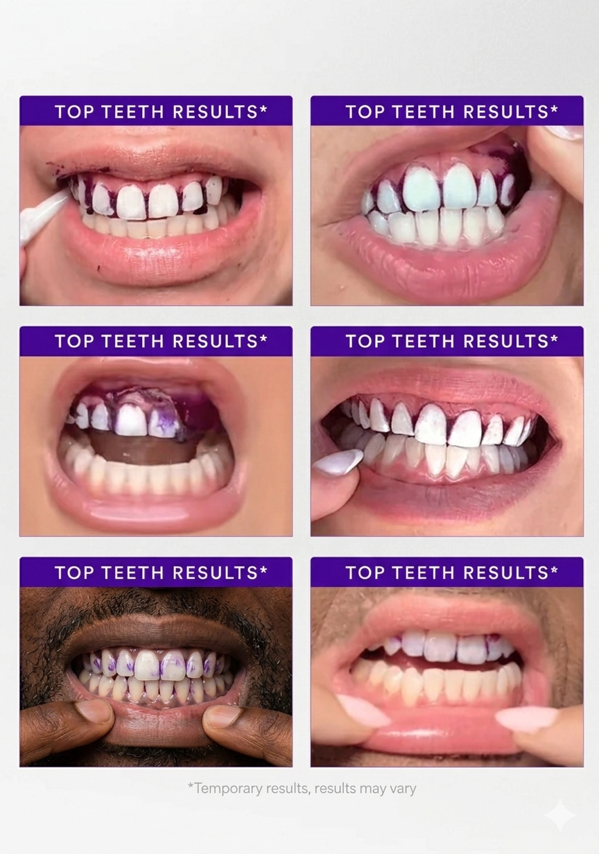 S26 Purple Whitening Strips