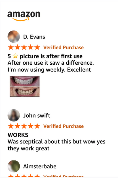 S26 Purple Whitening Strips